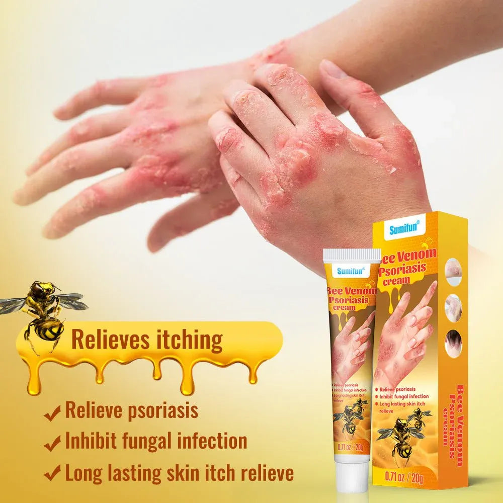 Sumifun Bee Venom Psoriasis & Eczema Relief Cream – Herbal Anti-Itch & Skin Repair Ointment (20g)