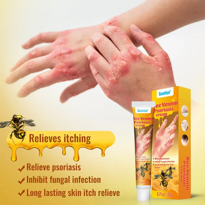 Sumifun Bee Venom Psoriasis & Eczema Relief Cream – Herbal Anti-Itch & Skin Repair Ointment (20g)