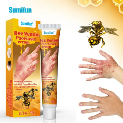 Sumifun Bee Venom Psoriasis & Eczema Relief Cream – Herbal Anti-Itch & Skin Repair Ointment (20g)